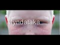 við Ingvi fórum á parkið smá bleita en bara gaman