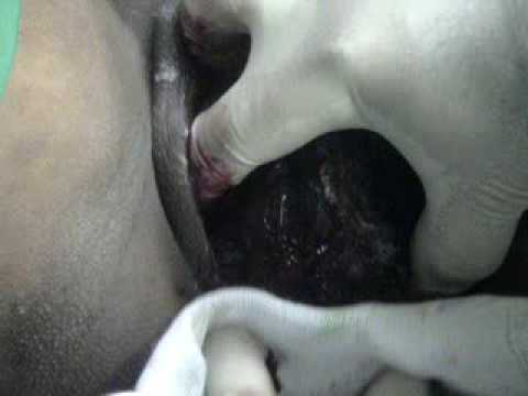 See video