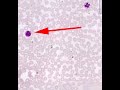 Shotgun Histology Blood Smear