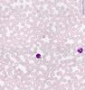 Shotgun Histology Blood Smear