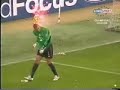 Goalie Burned by Firework