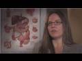 Colon Cleanse : How to Cleanse Your Colon Naturally