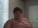 Canadian Patient 1 week after Mini-Gastric Bypass Canadian Patient 1 week after Mini-Gastric Bypass