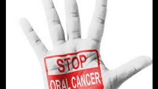 5 Actions Your Dental Hygienist Should Do For Your Oral Cancer Screening