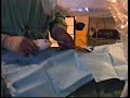 Epiduroscopy - Anaesthetic Techniques Epiduroscopy