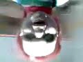 el pocholo esta loko
