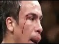 Manny Pacquiao Greatest Hits HBO 24/7