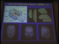 משב מוח: מסינפסות לרצון חופשי. שיעור 10