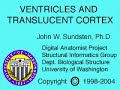 Neuroanatomy - ventricles & translucent cortex