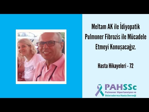 Hasta Hikayeleri - Meltem AK ile İdiyopatik Pulmoner Fibrozisle (akciğer sertleşmesi) Mücadele - 72 - 2023.01.10