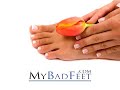 My Bad Feet (TV Commercial)