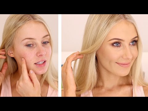 how to cover up acne without makeup