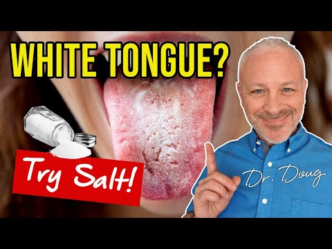 how to get rid white tongue