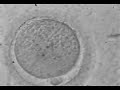 FERTILIZACION IN VITRO (ICSI)