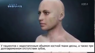 Установка зубных имплантов в Медицинском центре Сунчонхян