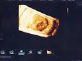 Week 7 Pregnancy Vlog- Ultrasound and Fetal Dating