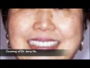 LVI Smile Cosmetic Dentists 2
