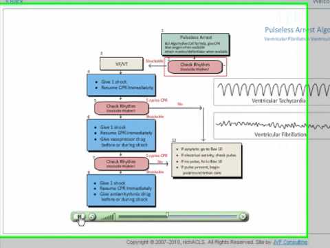 how to treat v tach with a pulse