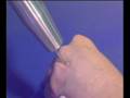 videos de Medlite pigmented lesion removal cut