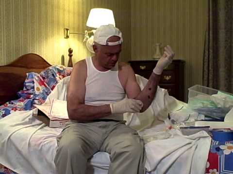 how to dissolve dvt naturally