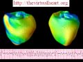 ventricular fibrillation, simulation in rabbit ventricles