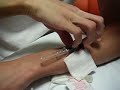 Self Infusion (First Attempt)