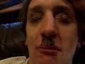 Hippi Terrorist vs. Adolf Schricke