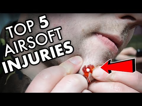 TOP 5 WORST AIRSOFT INJURIES