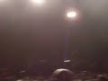Hombres G en directo: Marta tiene un marcapasos Hombres G en directo: Marta tiene un marcapasos