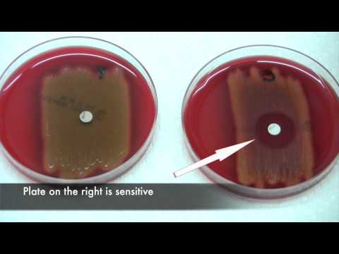 how to isolate streptococcus pyogenes