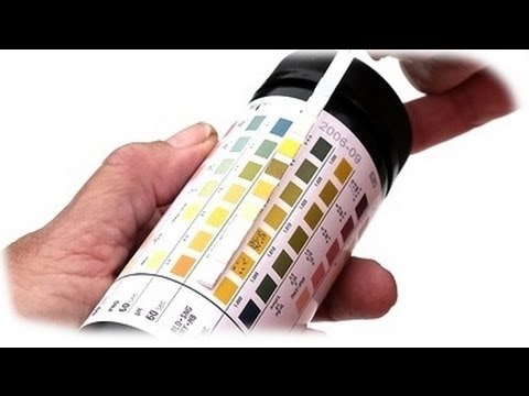 how to read urinalysis