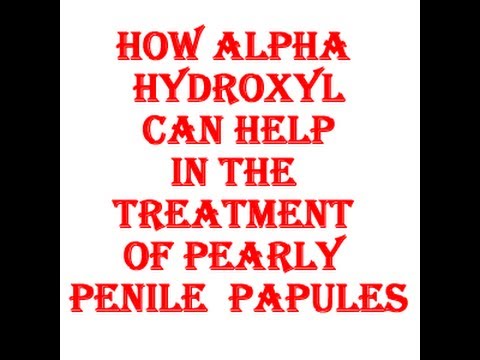 how to cure penile oedema