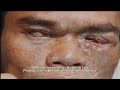 cambodia: how long will i survive?  kh en 