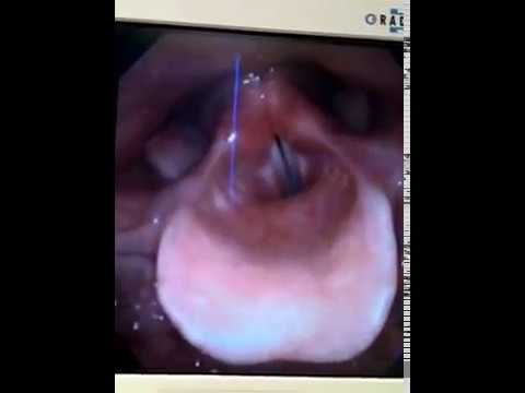 how to relieve a tickle in your throat