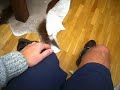 took off my prosthetic leg   