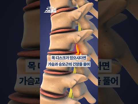 디스크 예방! 목 부담을 줄여주는 스트레칭
