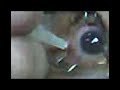 EYESHOT