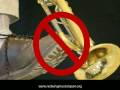 Emergency band repairs pt. 4