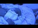Bilirubin lights Bilirubin