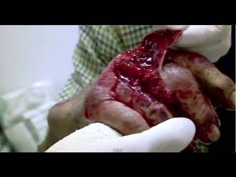 Bizarre Farm Injury - Bizarre ER