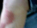 sangre en el bus