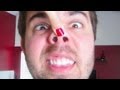 EPIC HANGOVER! (1.1.13 - Day 1342)