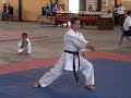 Down syndrome:&nbsp;S�ndrome de Down: Marco Antonio