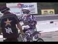 Carey Hart