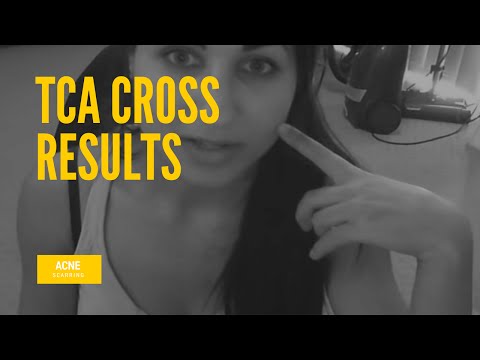 how to perform tca cross