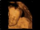 Window to the womb 4d baby scan of sonia and simon Window to the womb 4d baby scan of sonia and simon