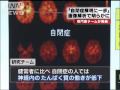脳の先天的な機能障害とされる自閉症について、浜松医科大などの研究チームが、脳のどの部分が健常者と違うか画像解析によって明らかにしたと発表しました。 ・・・記事の続き、その他のニュースはコチラから！ [テレビ朝日ANN NEWS] www.tv-asahi.co.jp