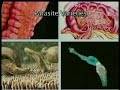 COLON DETOX COLON DETOX