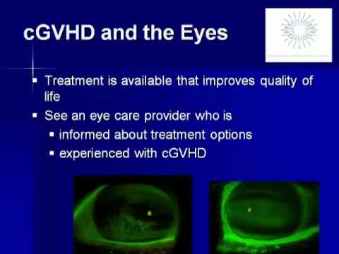 how to treat chronic gvhd
