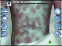 Trauma center under the knife 2 walkthrough operation 5